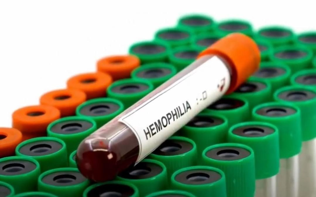 Programa especial visibilizará el contexto de las Personas con Hemofilia en Costa Rica