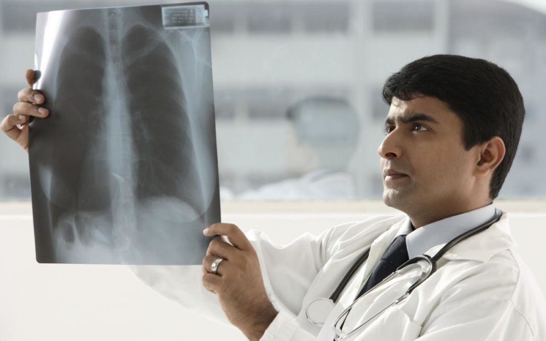 Pacientes con EPOC tienen entre 2 y 6 veces más riesgo de desarrollar cáncer de pulmón