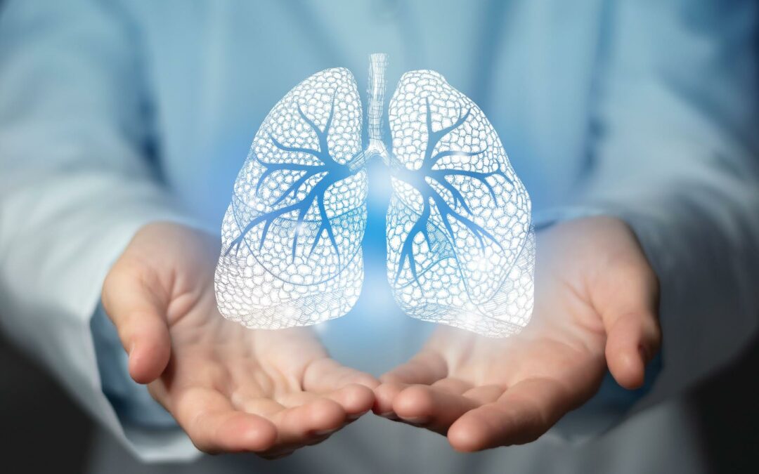 El costo de la inacción en cáncer de pulmón genera un aumento en el número de muertes prematuras