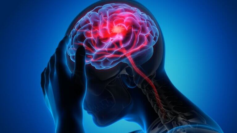 ¿Cómo prevenir un Accidente Cerebrovascular?