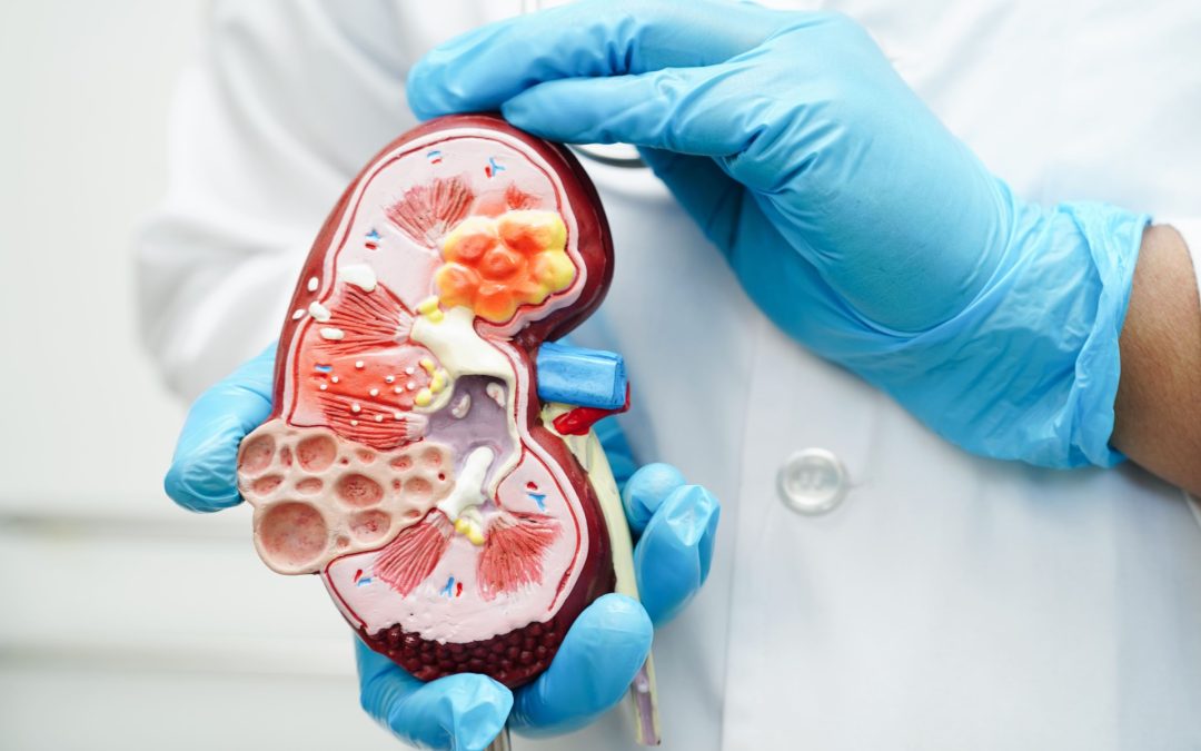 Hiperkalemia: AstraZeneca introduce nuevo tratamiento a Costa Rica para tratar la enfermedad